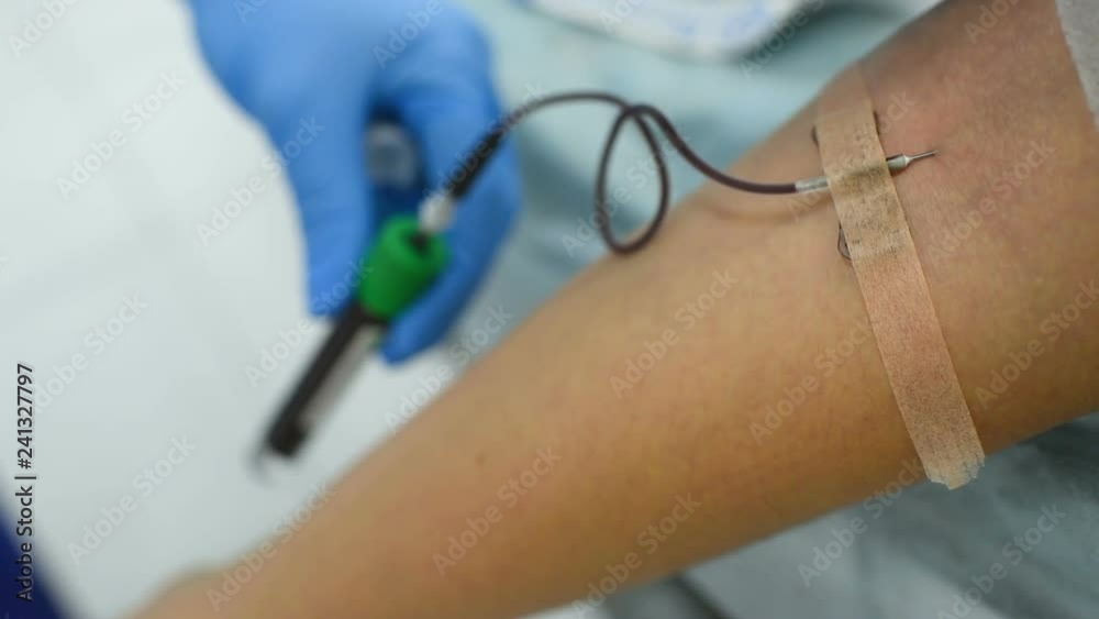 the doctor takes blood from the patient before plasmolifting the doctor takes blood from the patient before plasmolifting