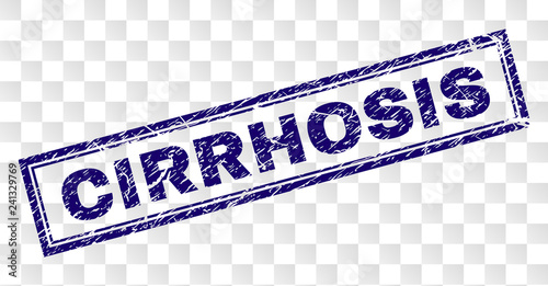 CIRRHOSIS stamp seal print with corroded style and double framed rectangle shape. Stamp is placed on a transparent background. Blue vector rubber print of CIRRHOSIS tag with corroded texture.