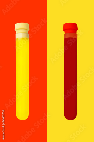 Urine and blood testing.