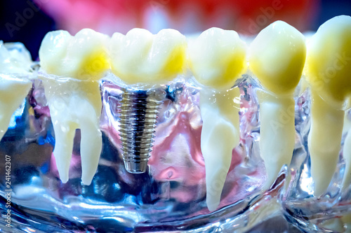 Mock gums with teeth. Artif...