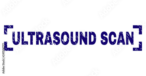 ULTRASOUND SCAN label seal imprint with distress texture. Text label is placed between corners. Blue vector rubber print of ULTRASOUND SCAN with scratched texture.