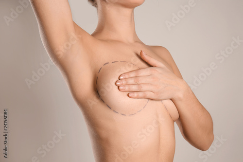 Fototapeta Young woman with marks on breast for cosmetic surgery operation against grey bac