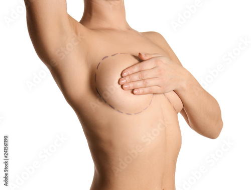 Young woman with marks on breast for cosmetic surgery operation against white background