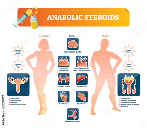 Anabolic steroids vector illustration. Labeled diagram with health symptoms