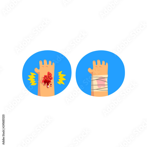 Wounded hand, physical injury, first aid and treatment vector Illustration on a white background
