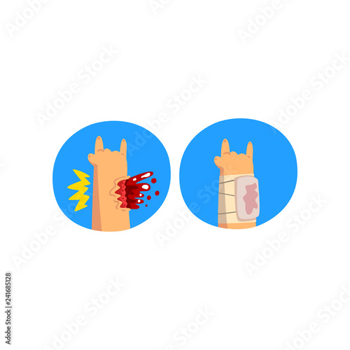 Wounded hand with blood oozing, first aid and treatment vector Illustration on a white background