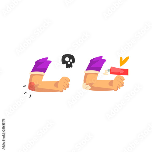 Elbow injury, first aid and treatment vector Illustration isolated on a white background