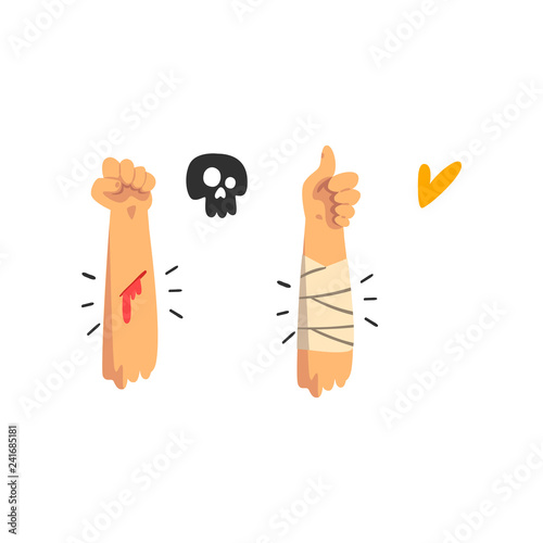 Bleeding wound on the hand, physical injury, bandaged hand, first aid and treatment vector Illustration on a white background