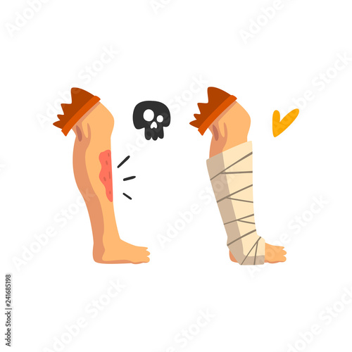 Wounded leg, physical injury, bandaged leg, first aid and treatment vector Illustration on a white background