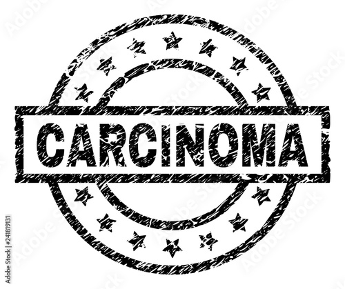 CARCINOMA stamp seal watermark with distress style. Designed with rectangle, circles and stars. Black vector rubber print of CARCINOMA text with retro texture.