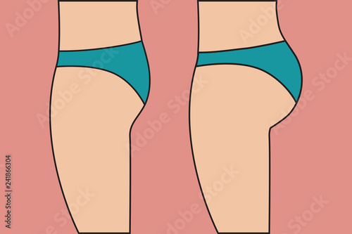changing shape of body