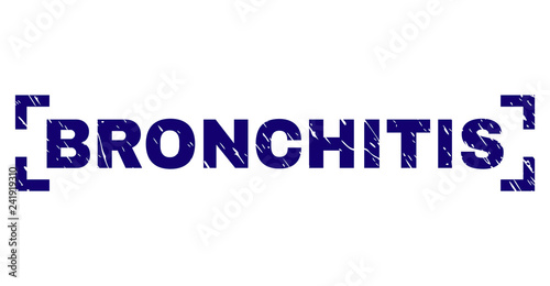 BRONCHITIS text seal print with corroded texture. Text label is placed between corners. Blue vector rubber print of BRONCHITIS with unclean texture.
