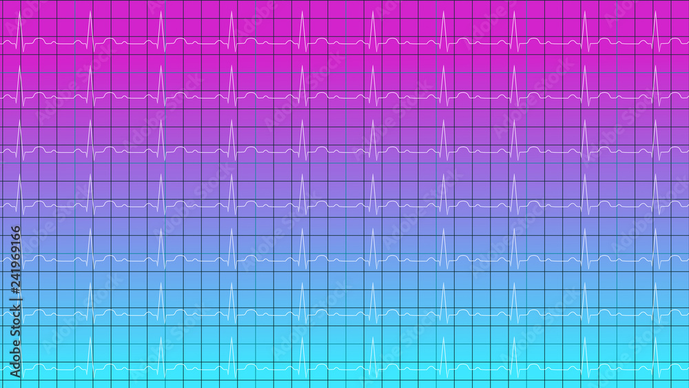 Cardiogram on gradient blue violet background 3D illustration Cardiogram on gradient blue violet background 3D illustration