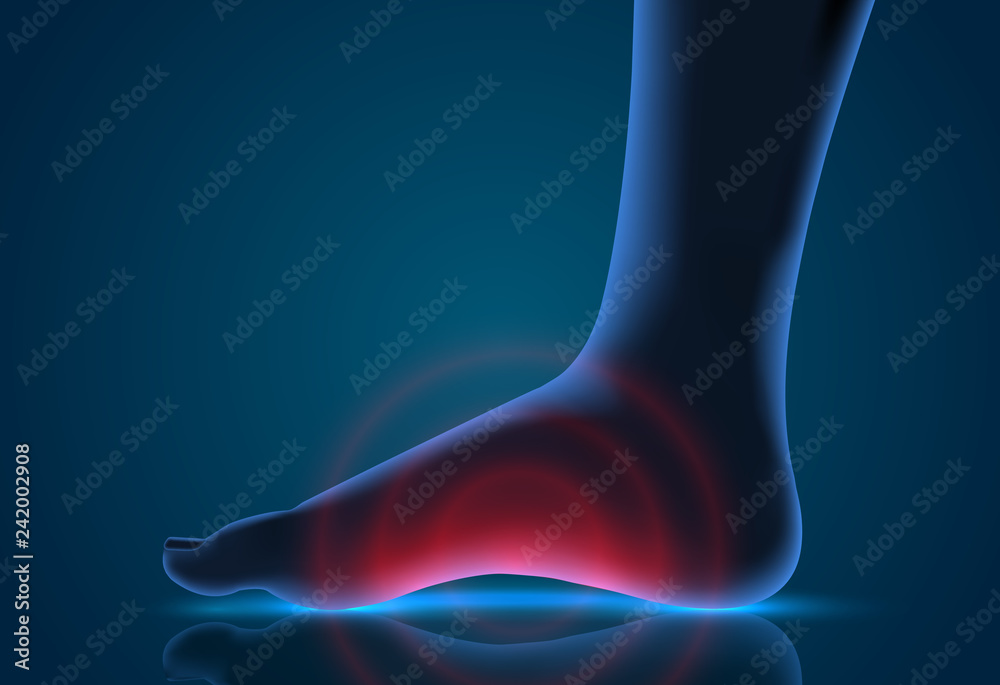 vector human foot. blue contour and red spots of pain. ready element for medicine and orthopedics vector human foot. blue contour and red spots of pain. ready element for medicine and orthopedics