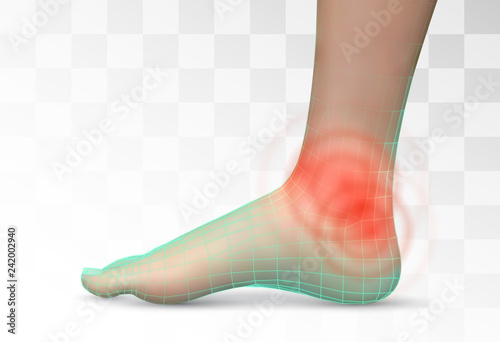 vector human foot.red spots of pain. ready element for medicine and orthopedics