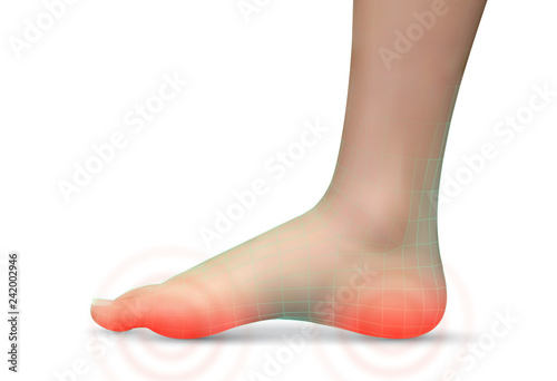 vector human foot.red spots of pain. ready element for medicine and orthopedics
