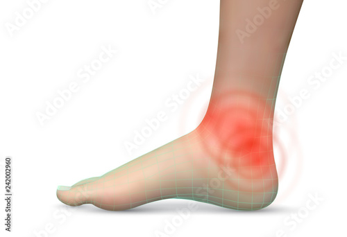 vector human foot.red spots of pain. ready element for medicine and orthopedics