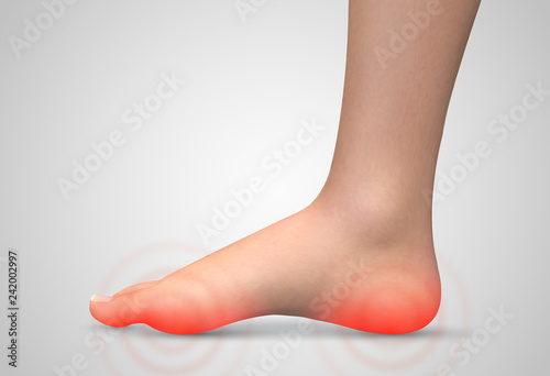 vector human foot.red spots of pain. ready element for medicine and orthopedics