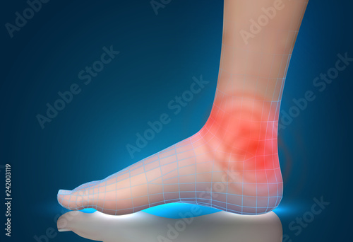 vector human foot.red spots of pain. ready element for medicine and orthopedics