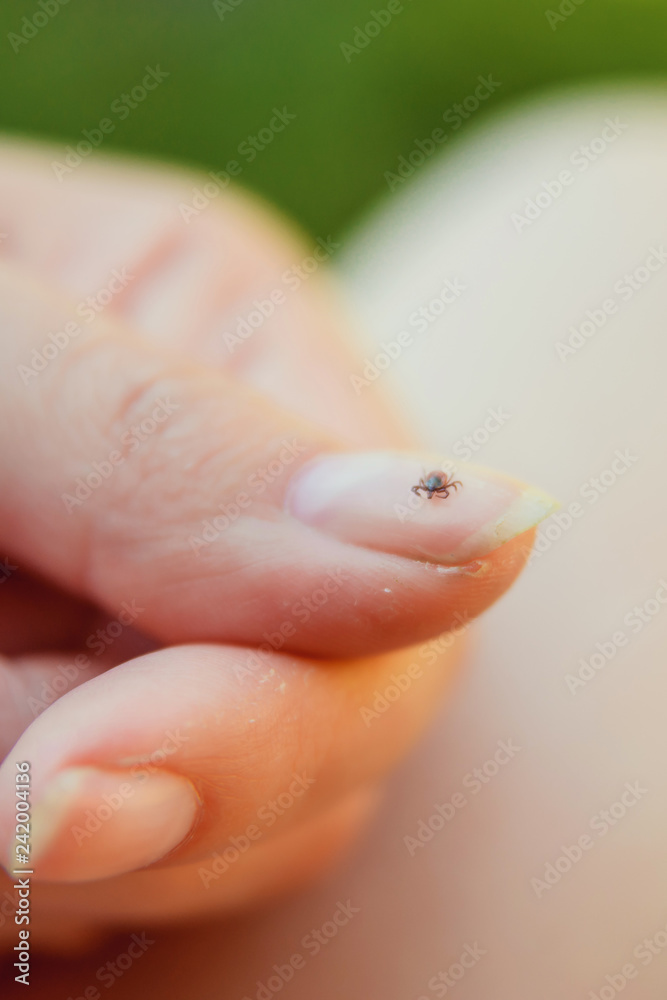 Tick crawling on finger. The concept of danger of tick bite. Tick crawling on finger. The concept of danger of tick bite.