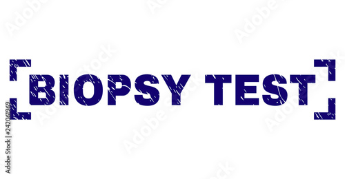 BIOPSY TEST text seal print with grunge effect. Text label is placed between corners. Blue vector rubber print of BIOPSY TEST with grunge texture.