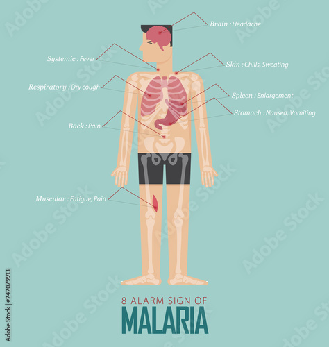 Alarm signs of Malaria infographic in flat design. Malaria disease symptom icon set  with human body, skeleton and organ. Vector Illustration.