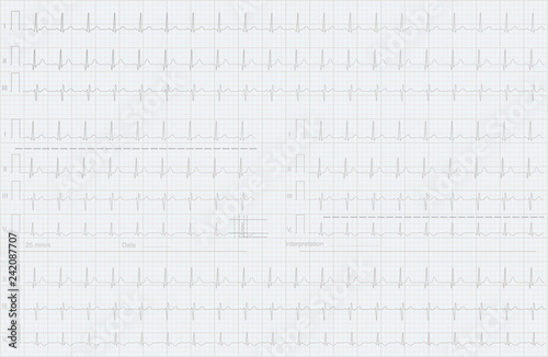 ECG lines background