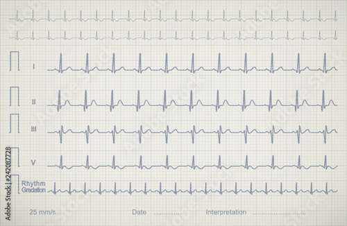 ECG chart image of medical patient
