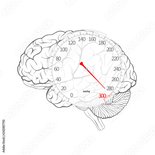 Red arrow of blood pressure dial on the brain