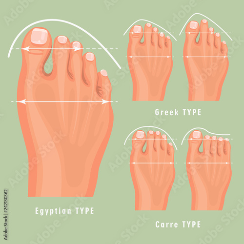 Foot type vector detailed concept with germanic, celtic, greek and roman form
