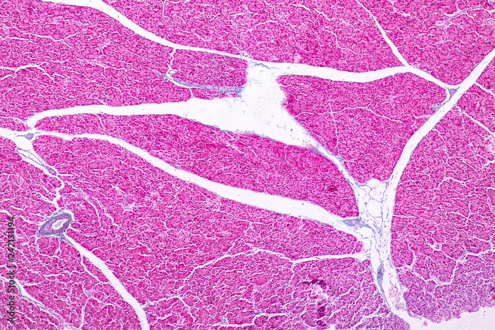 Tissue of pancreas is an organ of the digestive system and endocrine ...