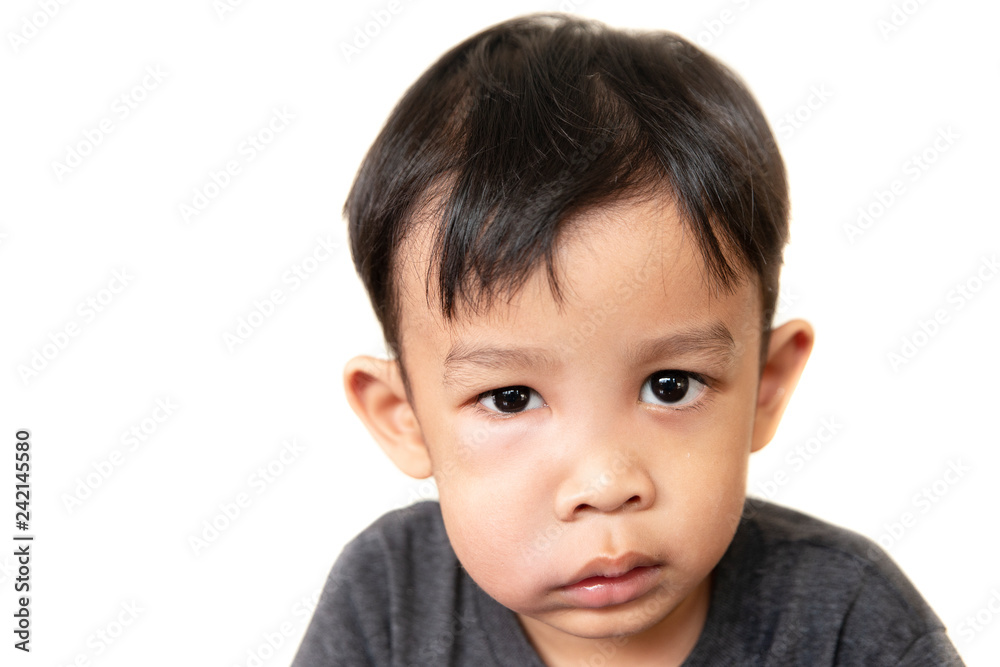 swollen face of asian kid suffering from health problem and aching tooth, showing dissatisfaction. dental concept. swollen face of asian kid suffering from health problem and aching tooth, showing dissatisfaction. dental concept.