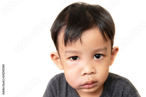 Fototapeta swollen face  of asian kid suffering from health problem and aching tooth, showing dissatisfaction