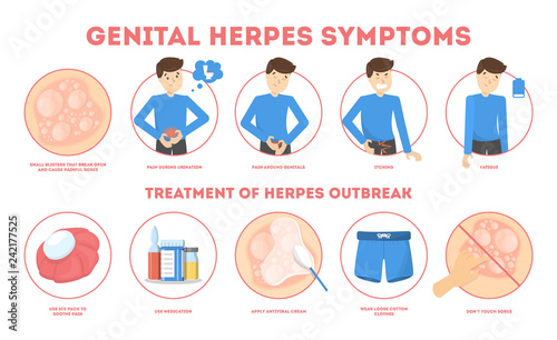 Genital herpes symptoms. Infectious dermatology disease illustration photo