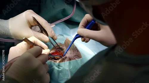 Surgeon conducting a head surgery. photo