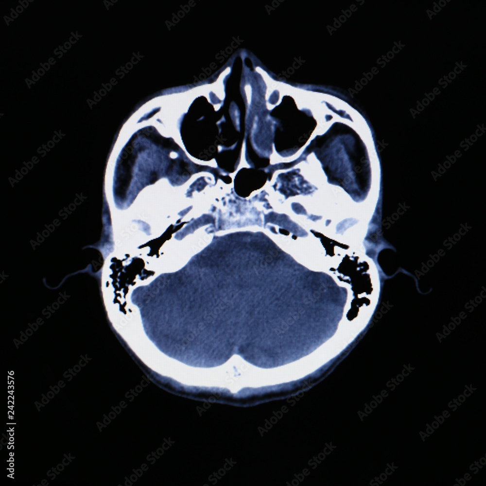 X-ray scanner of head background.