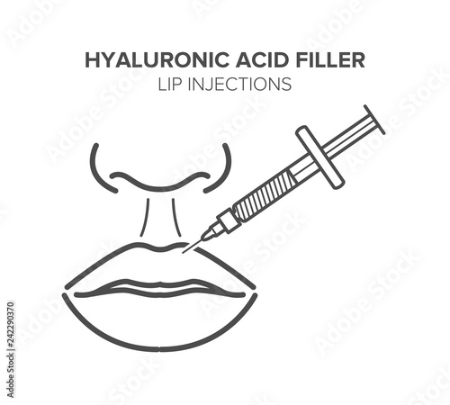 Lip injections. Hyaluronic acid filler. Vector illustration