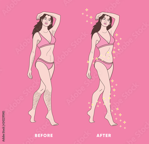 woman body hair removal