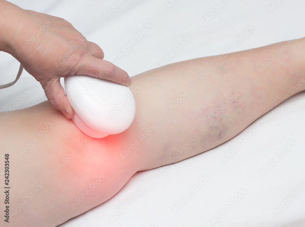 Treatment of osteoarthritis of the knee by magnetic therapy, physiotherapy, inflammation of the knee, close-up Treatment of osteoarthritis of the knee by magnetic therapy, physiotherapy, inflammation of the knee, close-up