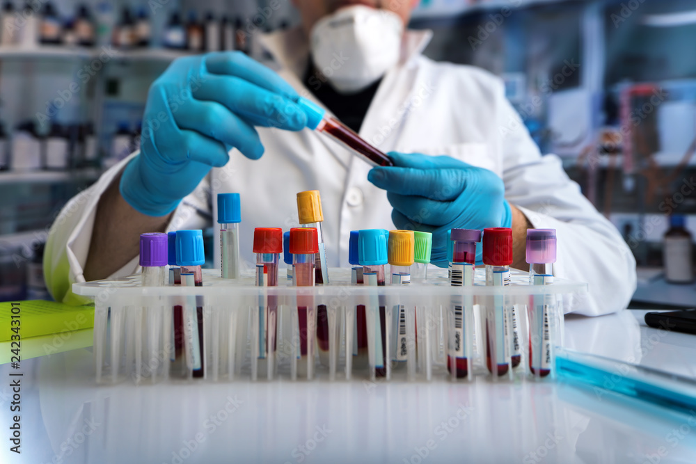 lab technician holding blood tube of the rack in the hematology laboratory / hands of doctor working with blood test tube for analysis in the lab lab technician holding blood tube of the rack in the hematology laboratory / hands of doctor working with blood test tube for analysis in the lab