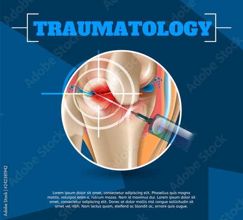 Realistic Illustration Traumatology Medicine in 3d