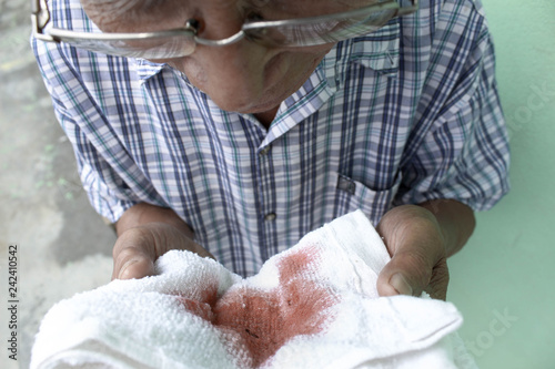 Old Asian man holding white fabric with blood from cough. Health problem in elderly.
