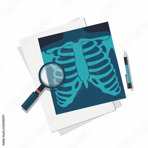 Medicine concept. X-ray lungs, magnifier and pen. 