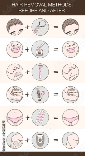 Before and after infographic of hair removal