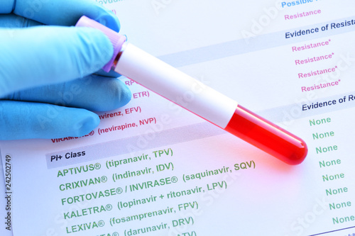 Laboratory results of HIV drugs resistance with blood sample
 photo