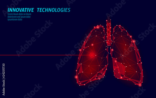 Human lungs laser surgery operation low poly. Medicine disease drug treatment painful area. Red triangles polygonal 3D render shape. Pharmacy tuberculosis cancer template vector illustration