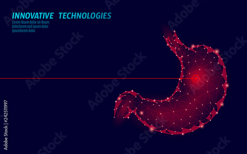 Human stomach laser surgery operation low poly. Medicine disease drug treatment painful area. Red triangles polygonal 3D render shape. Pharmacy business poster template vector illustration