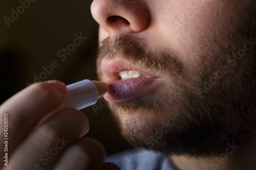 Young man with a beard repairing his damaged lips with moisturizer