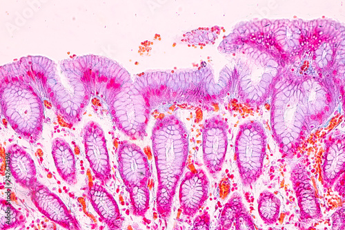 Tissue of Stomach under the microscopic, Physiology of the stomach for education in laboratory.