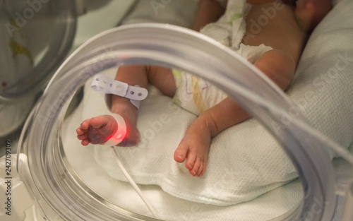 New born baby at the hospital in neonatal care  photo